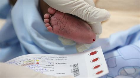 Esquema de la extracción de sangre del talón de un bebé para el tamizaje neonatal