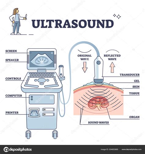 Esquema de un ecógrafo en funcionamiento mostrando una imagen fetal