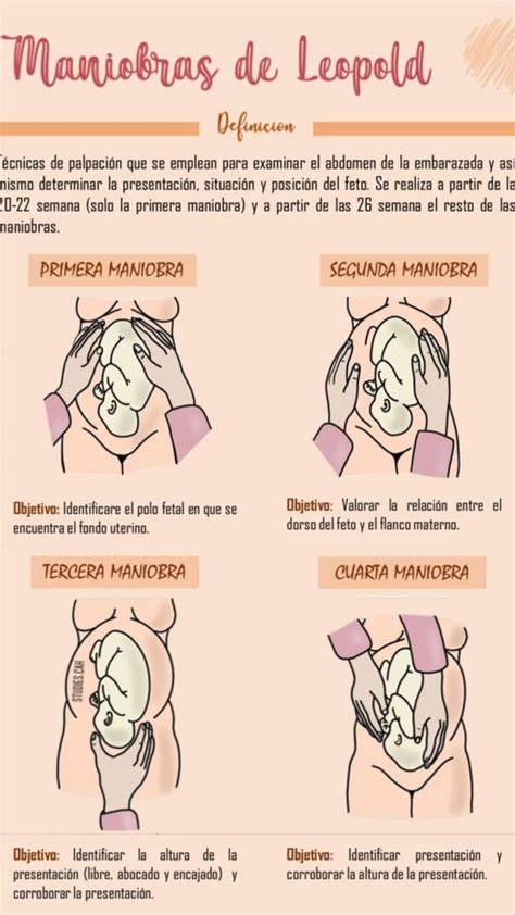 Esquema de las Maniobras de Leopold para determinar la posición fetal