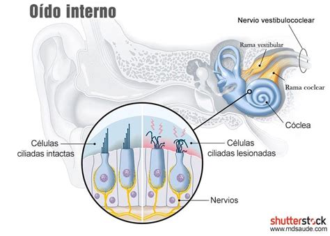 Infografía mostrando la anatomía del oído y cómo el ruido afecta las células ciliadas