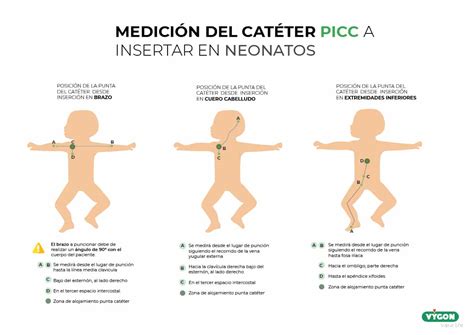 Infografía: Complicaciones frecuentes del PICC en neonatos