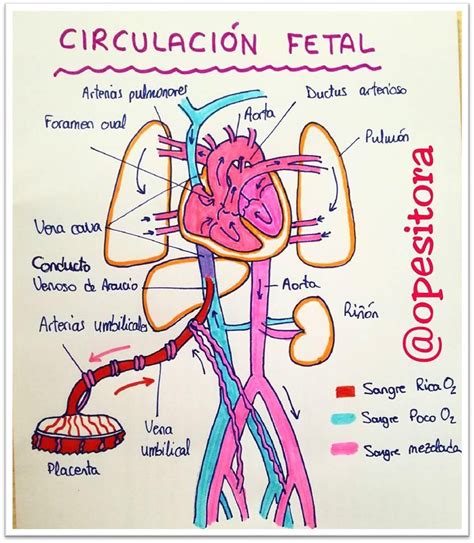 Esquema del corazón fetal con indicación de derrame pericárdico