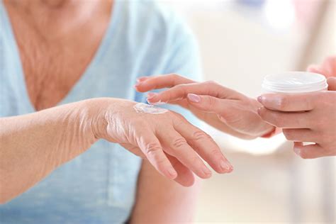 Fotografía de un cuidador aplicando crema protectora en la piel de un adulto mayor.
