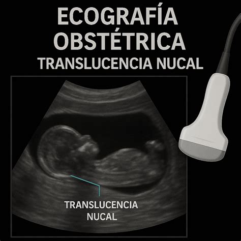 Diagrama mostrando la ecografía de translucencia nucal y la extracción de sangre para marcadores bioquímicos