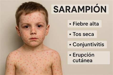 Esquema de las diferentes características de los exantemas maculopapulares
