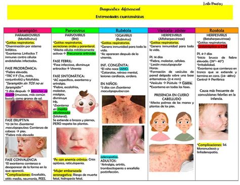 Tabla comparativa de exantemas víricos comunes en la infancia