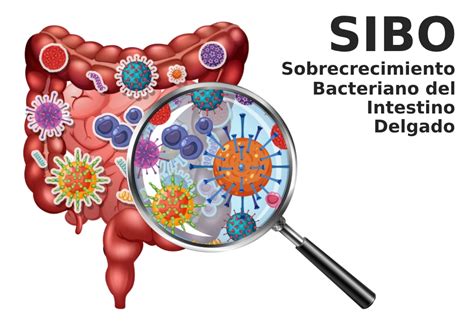 Infografía explicativa de la distensión abdominal y el sobrecrecimiento bacteriano intestinal (SIBO)