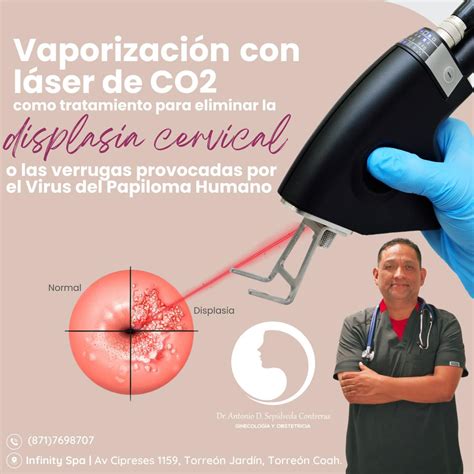 Infografía: Impacto de la displasia cervical y su tratamiento en las tasas de embarazo y riesgo de aborto.
