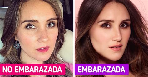 Esquema de los ojos de una mujer embarazada y cambios hormonales