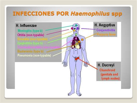 infografía detallando las incidencias de infecciones por Haemophilus spp. en diferentes grupos de edad y condiciones (embarazadas, neonatos, VIH)