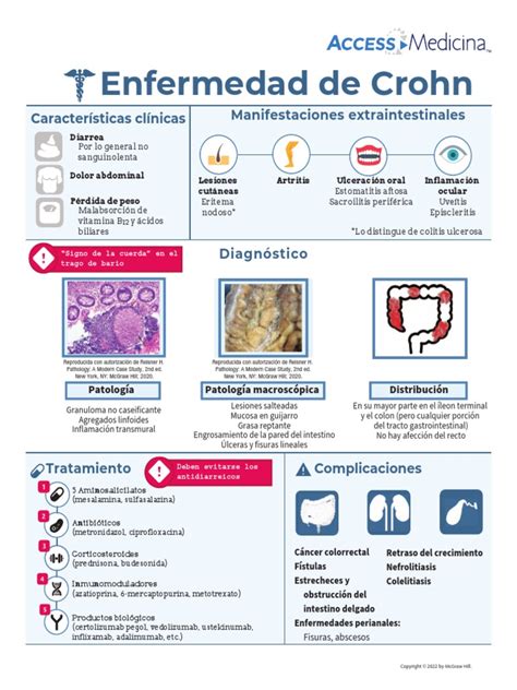 Esquema visual del algoritmo diagnóstico para la Enfermedad de Crohn Pediátrica