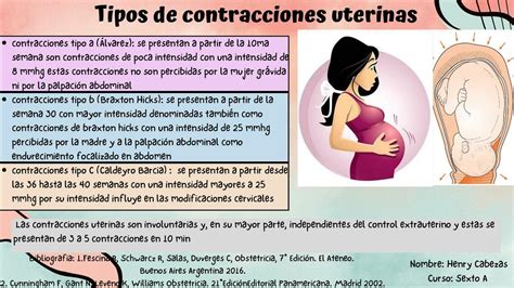 Representación de las contracciones uterinas durante el parto