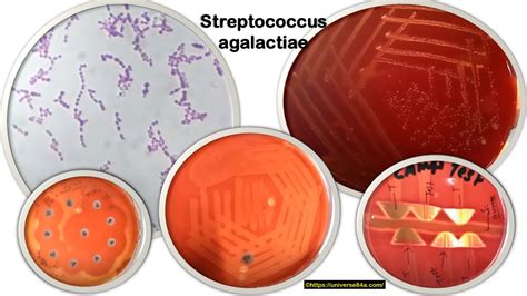Diagrama que ilustra la ruta de transmisión del Streptococcus agalactiae de la madre al bebé durante el parto.