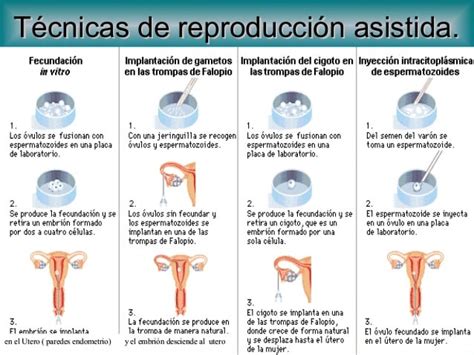 Esquema de las técnicas de recuperación de espermatozoides
