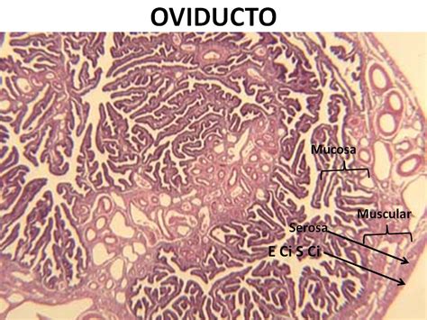 Fotografía microscópica de un corte histológico de oviducto de avestruz mostrando pliegues de la mucosa y glándulas