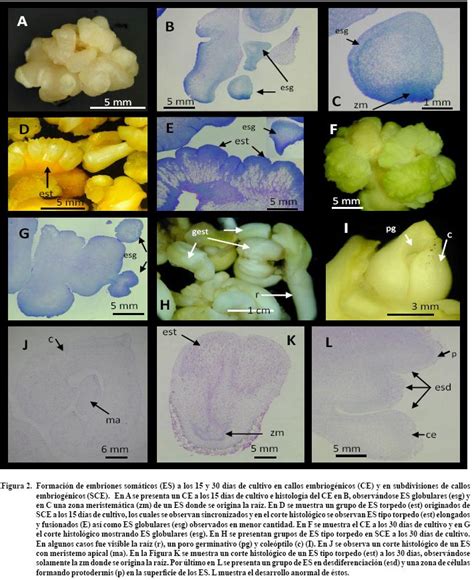 Micrografía de células de callo embriogénico de Pinus pinaster con expresión de gen reportero GUS