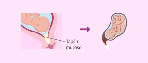 Ilustración del cuello del útero con el tapón mucoso en su interior, mostrando la barrera protectora.