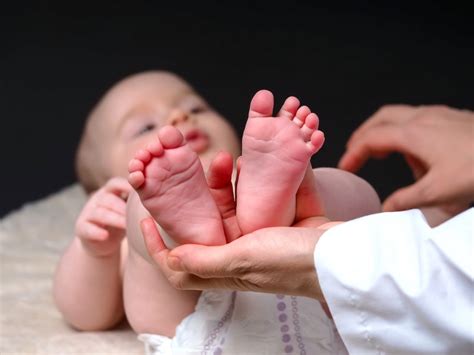 Neuropediatra examinando los reflejos de un bebé