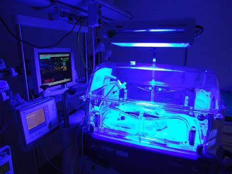 Bebé recibiendo fototerapia bajo luces azules especiales.