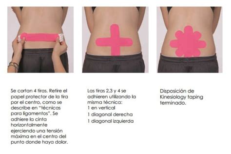 Infografía detallando los pasos para la correcta aplicación del kinesiotape en la zona lumbar