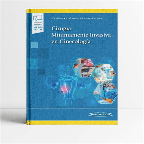 Diagrama de técnicas de cirugía mínimamente invasiva en ginecología