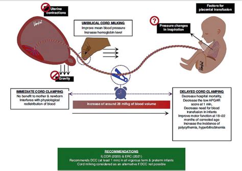 Esquema: Técnica de ordeño del cordón umbilical