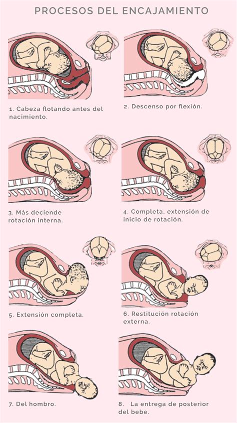 Diagrama de la rotación de la cabeza fetal a través de la pelvis