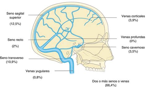 Ilustración esquemática de los senos venosos cerebrales