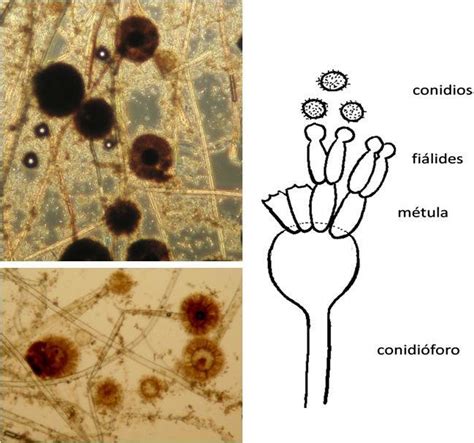 Micrografía detallada de conidios y conidióforos de Alternaria