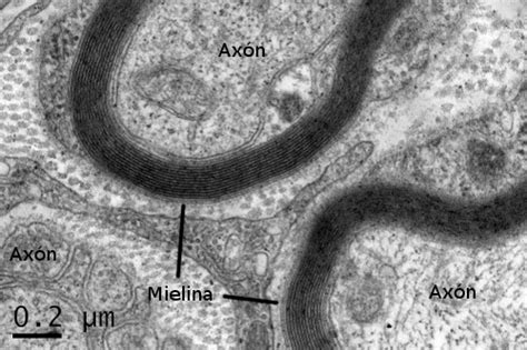 Micrografía: Axón mielinizado