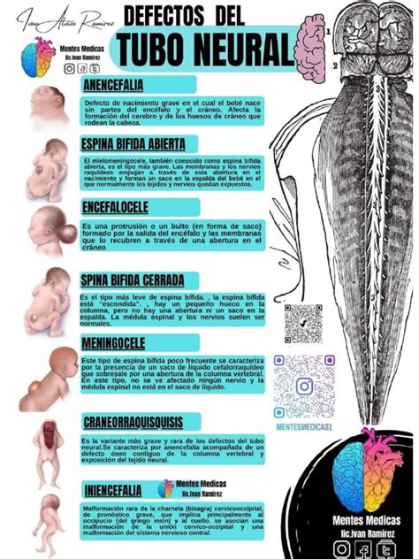 Esquema del desarrollo del tubo neural y los defectos asociados