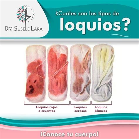 Infografía: Etapas y duración de los loquios en el posparto