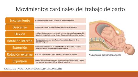 Esquema anatómico mostrando el mecanismo de impactación del hombro fetal en la sínfisis púbica durante el parto.
