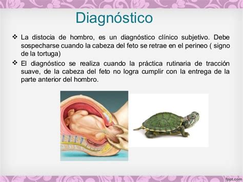 Ilustración clínica del 