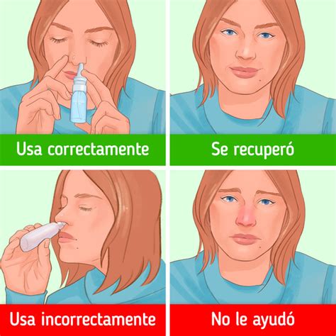 Ilustración detallada de la técnica correcta para aplicar el aerosol nasal de fluticasona en niños