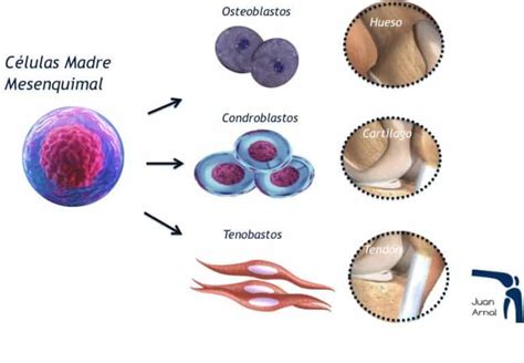 Infografía: Diferencia entre células madre hematopoyéticas y mesenquimales