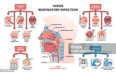 Esquema de las vías respiratorias afectadas por el resfriado y la gripe