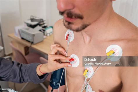 Imagen de un paciente monitorizado con electrodos colocados para una cardioversión