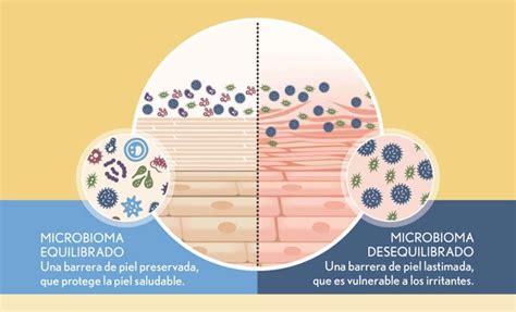 Infografía sobre las funciones del microbioma de la piel
