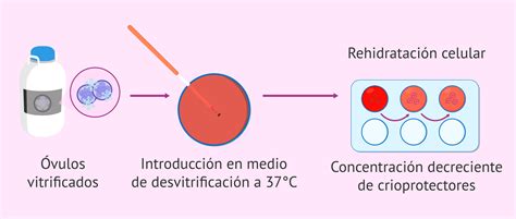 Diagrama que muestra los pasos del proceso de desvitrificación de embriones.