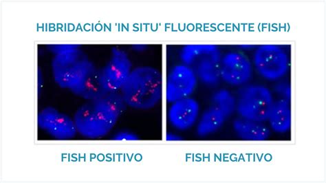 Infografía comparativa de las técnicas FISH y array-CGH para el estudio cromosómico del embrión