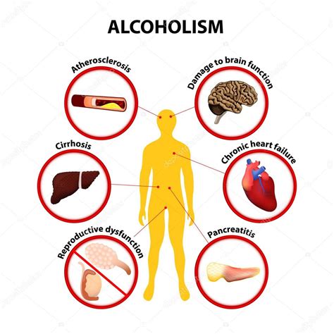 Ilustración de los riesgos del alcohol para el desarrollo fetal