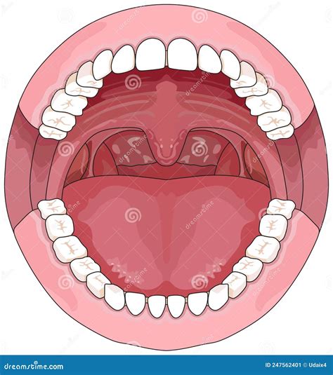 Ilustración de una boca abierta mostrando la lengua y las amígdalas para indicar la posible localización de problemas de mal aliento.