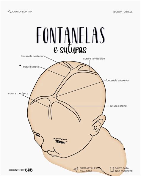 Esquema de las fontanelas en el cráneo de un neonato