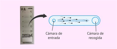 Esquema de funcionamiento de las técnicas MACS y Chip Fertile