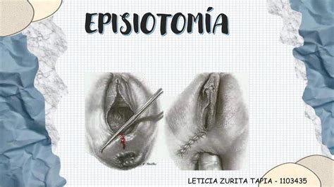 Gráfico comparativo de tasas de episiotomía entre hospitales madrileños.
