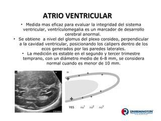 Ejemplo de medición del atrio ventricular fetal en ecografía.
