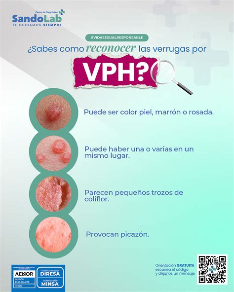 Esquema de las diferentes localizaciones de los condilomas genitales femeninos