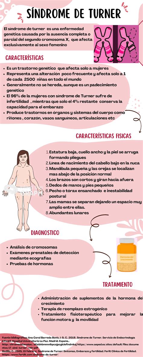 Infografía: Características clínicas del Síndrome de Turner