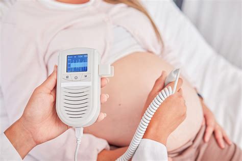 Esquema de monitorización fetal electrónica y registro de frecuencia cardíaca